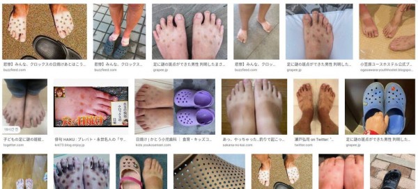 20220415_161824.jpg 요즘 일본에서 유행한다는 피부 관련 증상.jpg